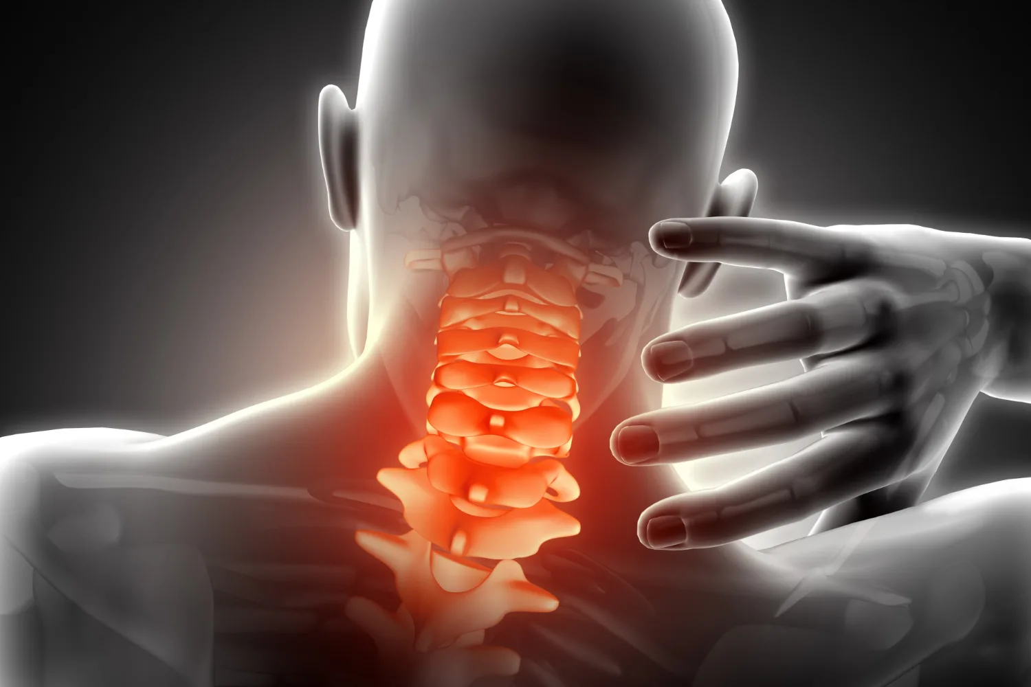 Cirugía cervical anterior