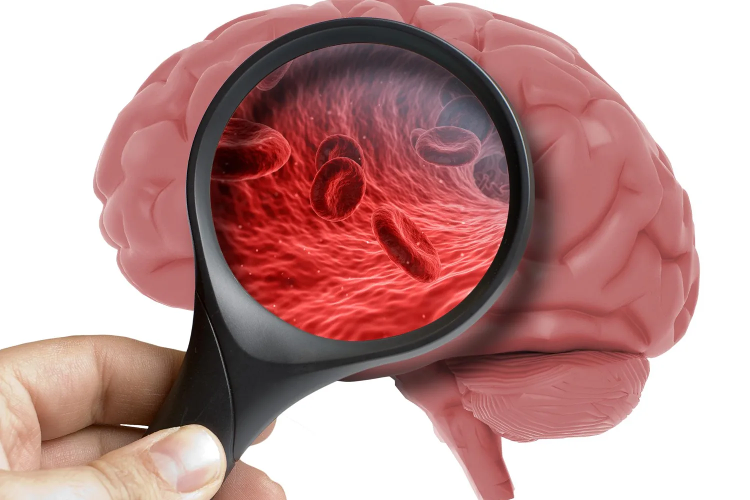 Cirugía de tumores cerebrales en Zapopan, Jalisco: Precisión y Cuidado Avanzado