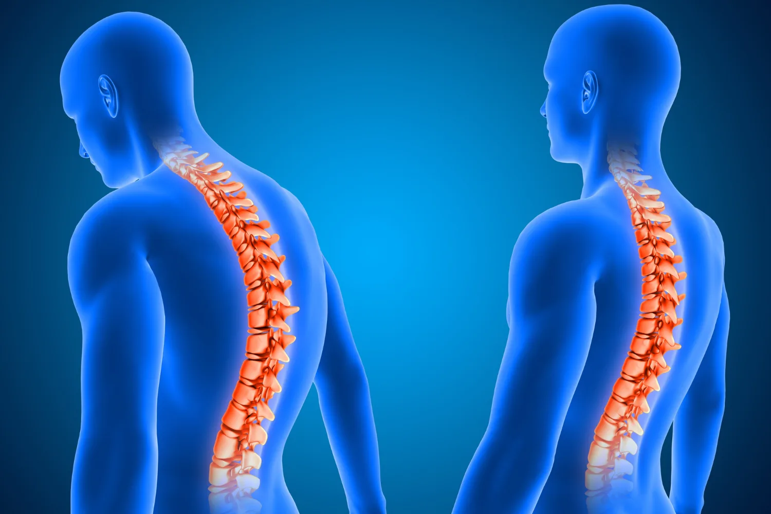 Cirugía endoscópica de columna