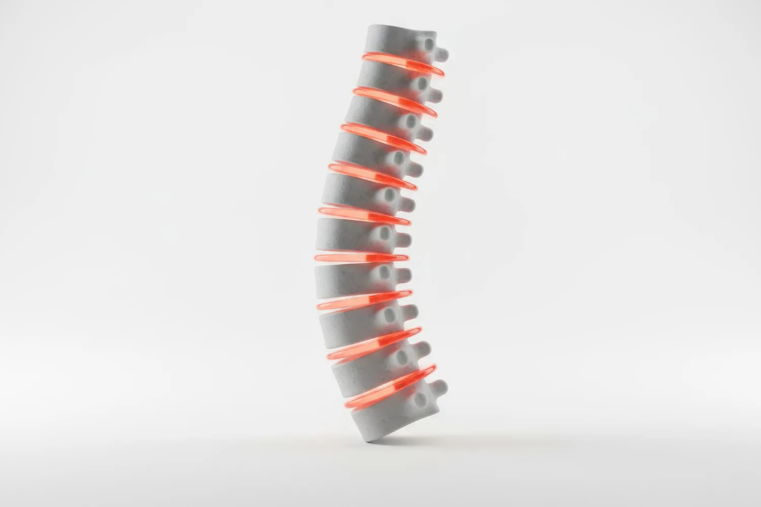 Estimulación medular en Zapopan, Jalisco.: Una solución avanzada para el dolor crónico