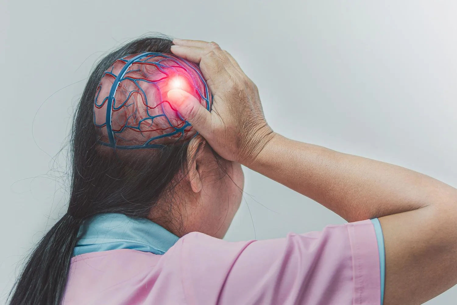 Evacuación de hematoma subdural en Zapopan, Jalisco.: Cirugía cerebral mínimamente invasiva